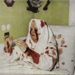 ظاهرة ال “ستيجماتا”تحت المجهر